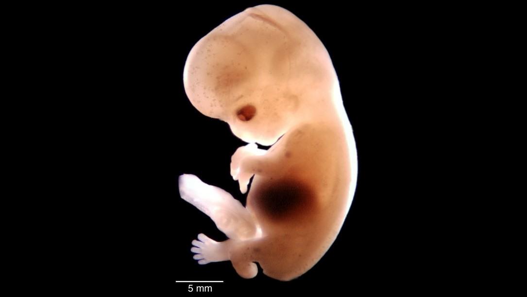 An embryo.