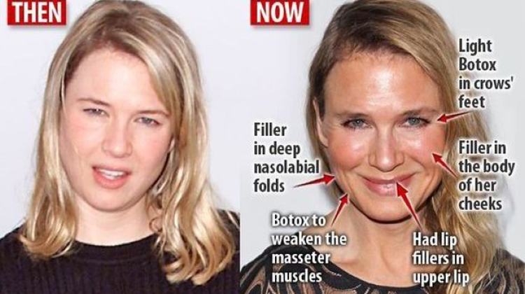 Plastic surgery